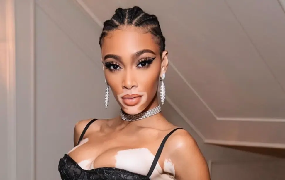 Winnie Harlow Measurements